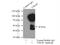 Tyrosyl-DNA Phosphodiesterase 2 antibody, 12203-1-AP, Proteintech Group, Immunoprecipitation image 