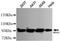 MutS Homolog 2 antibody, M00140-4, Boster Biological Technology, Western Blot image 