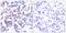 JunB Proto-Oncogene, AP-1 Transcription Factor Subunit antibody, GTX50106, GeneTex, Immunohistochemistry paraffin image 