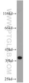 Mitochondrial Genome Maintenance Exonuclease 1 antibody, 23178-1-AP, Proteintech Group, Western Blot image 