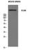 Versican antibody, STJ96239, St John