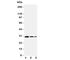 TNF Receptor Associated Factor 1 antibody, R31113, NSJ Bioreagents, Western Blot image 