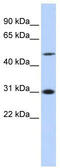 Inhibitor Of Growth Family Member 3 antibody, TA333745, Origene, Western Blot image 