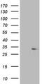 Short Chain Dehydrogenase/Reductase Family 9C Member 7 antibody, CF502013, Origene, Western Blot image 