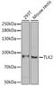 Tousled Like Kinase 2 antibody, GTX32923, GeneTex, Western Blot image 