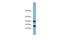 Trafficking Protein Particle Complex 2 Like antibody, A12900, Boster Biological Technology, Western Blot image 