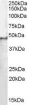 Splicing Factor 3b Subunit 4 antibody, TA302812, Origene, Western Blot image 