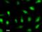 Aryl Hydrocarbon Receptor Nuclear Translocator Like 2 antibody, LS-C342828, Lifespan Biosciences, Immunofluorescence image 