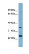 Nitric Oxide Synthase Interacting Protein antibody, orb330894, Biorbyt, Western Blot image 