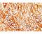 Keratin 18 antibody, orb248452, Biorbyt, Immunohistochemistry paraffin image 