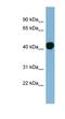 H2A Histone Family Member Y antibody, NBP1-53018, Novus Biologicals, Western Blot image 