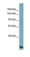 VPS41 Subunit Of HOPS Complex antibody, orb330286, Biorbyt, Western Blot image 