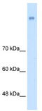 Neuronal Cell Adhesion Molecule antibody, TA336015, Origene, Western Blot image 