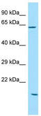 Sosondowah Ankyrin Repeat Domain Family Member C antibody, TA334403, Origene, Western Blot image 