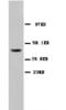 alpha-Tubulin antibody, orb18283, Biorbyt, Western Blot image 
