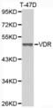 Vitamin D Receptor antibody, abx001806, Abbexa, Western Blot image 
