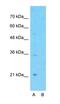 G Protein-Coupled Receptor Class C Group 5 Member A antibody, orb324956, Biorbyt, Western Blot image 