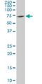 NME/NM23 Family Member 8 antibody, H00051314-M01, Novus Biologicals, Western Blot image 