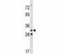Cyclin Dependent Kinase 4 antibody, F44483-0.4ML, NSJ Bioreagents, Western Blot image 