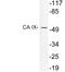 G250 antibody, LS-C199779, Lifespan Biosciences, Western Blot image 