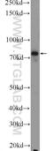 Coagulation Factor XIII A Chain antibody, 17223-1-AP, Proteintech Group, Western Blot image 