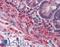 PR/SET Domain 5 antibody, LS-B3500, Lifespan Biosciences, Immunohistochemistry paraffin image 