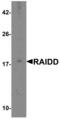 CASP2 And RIPK1 Domain Containing Adaptor With Death Domain antibody, 2406, QED Bioscience, Western Blot image 