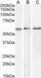 Calcium/Calmodulin Dependent Protein Kinase II Alpha antibody, GTX88413, GeneTex, Western Blot image 