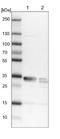 Centromere protein V antibody, NBP1-84546, Novus Biologicals, Western Blot image 