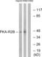 Protein Kinase CAMP-Dependent Type II Regulatory Subunit Beta antibody, abx012820, Abbexa, Western Blot image 