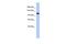 Transmembrane Protein 63C antibody, A15052, Boster Biological Technology, Western Blot image 