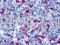 Ig kappa-b4 chain C region antibody, 691630, Progen Biotechnik GmbH, Enzyme Linked Immunosorbent Assay image 