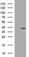 Fatty acid 2-hydroxylase antibody, M05657, Boster Biological Technology, Western Blot image 