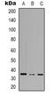 RASD Family Member 2 antibody, LS-C368793, Lifespan Biosciences, Western Blot image 