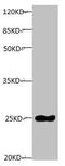 TIMP Metallopeptidase Inhibitor 1 antibody, CSB-MA0235601A0m, Cusabio, Western Blot image 