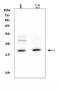 Interleukin 1 Receptor Antagonist antibody, A00651-3, Boster Biological Technology, Western Blot image 