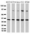 CUB Domain Containing Protein 1 antibody, M02411, Boster Biological Technology, Western Blot image 