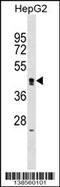 Zinc Finger Protein 556 antibody, 59-793, ProSci, Western Blot image 