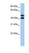 Spermatogenesis And Oogenesis Specific Basic Helix-Loop-Helix 1 antibody, NBP1-56762, Novus Biologicals, Western Blot image 