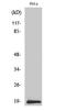 Synuclein Beta antibody, A07381, Boster Biological Technology, Western Blot image 