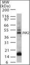 Mitogen-Activated Protein Kinase 9 antibody, orb87938, Biorbyt, Western Blot image 