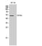 Cytochrome P450 Family 2 Subfamily R Member 1 antibody, A03557-1, Boster Biological Technology, Western Blot image 