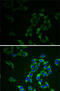Adenylate Kinase 1 antibody, 14-299, ProSci, Immunofluorescence image 