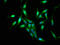 S100 Calcium Binding Protein A9 antibody, LS-C376553, Lifespan Biosciences, Immunofluorescence image 