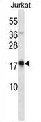 Thymic Stromal Lymphopoietin antibody, AP54374PU-N, Origene, Western Blot image 