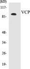 Valosin Containing Protein antibody, EKC1592, Boster Biological Technology, Western Blot image 