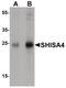 Shisa Family Member 4 antibody, PA5-34528, Invitrogen Antibodies, Western Blot image 