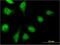 Prefoldin Subunit 2 antibody, H00005202-M07, Novus Biologicals, Immunofluorescence image 