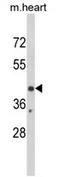 Early Growth Response 3 antibody, AP17312PU-N, Origene, Western Blot image 