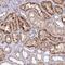 Beta-1,4-Galactosyltransferase 4 antibody, PA5-61342, Invitrogen Antibodies, Immunohistochemistry paraffin image 